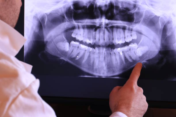 Emergency Dentist for Special Needs Patients