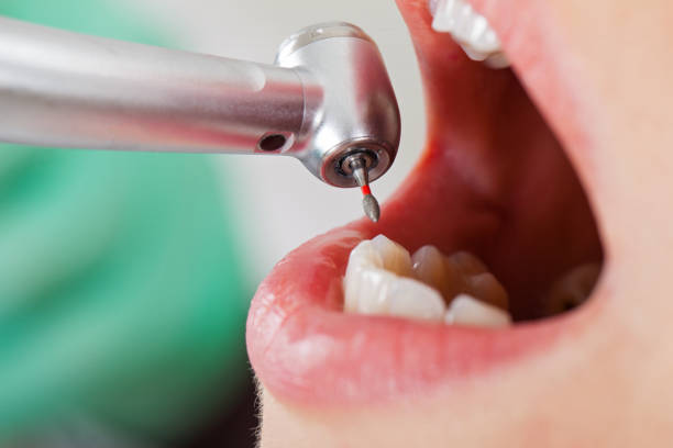 Mobile Emergency Dentist